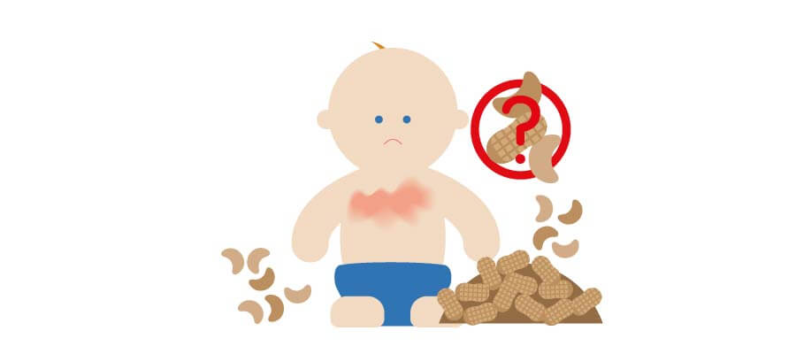 Illustration bébé souffrant d’allergies