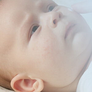 Baby allergies_02_LEARN_Ask the expert_01 Baby allergies_02_LEARN_Ask the expert_01